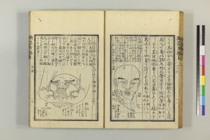 広恵済急方 3巻 - ページ 29