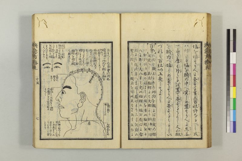 広恵済急方 3巻 - ページ 31