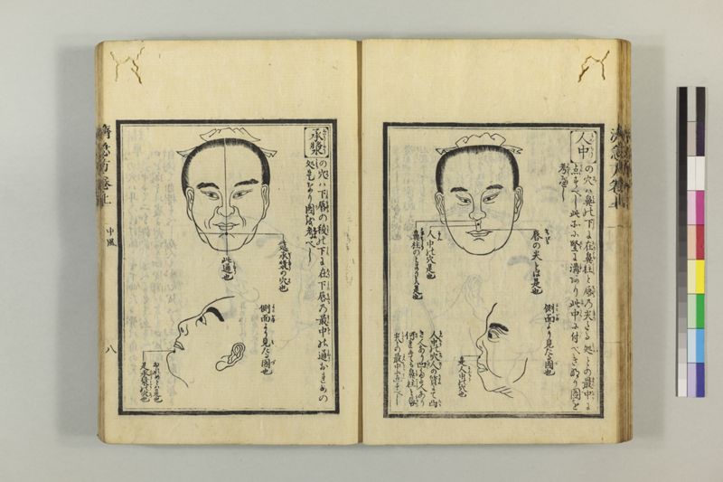 広恵済急方 3巻 - ページ 32