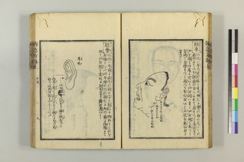 広恵済急方 3巻 - ページ 33