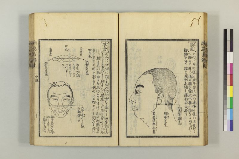 広恵済急方 3巻 - ページ 34