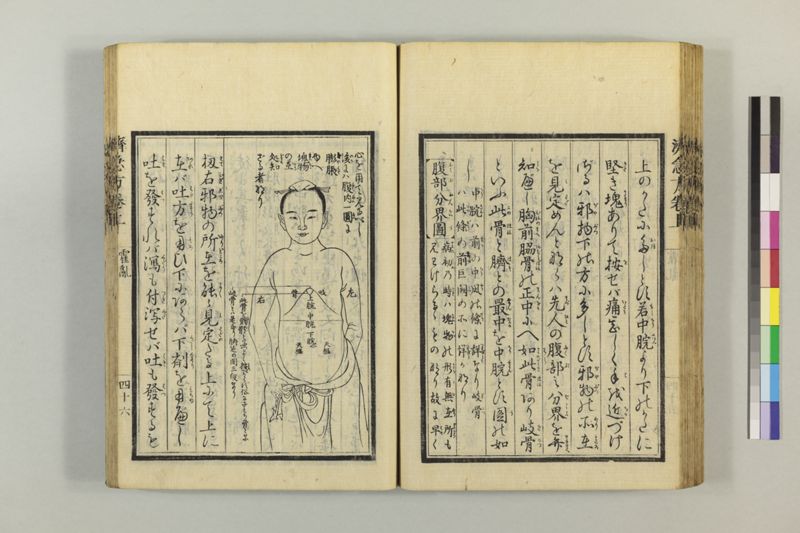 広恵済急方 3巻 - ページ 70