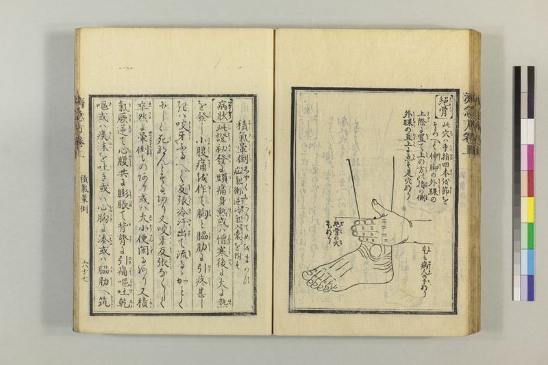 広恵済急方 3巻 - ページ 92