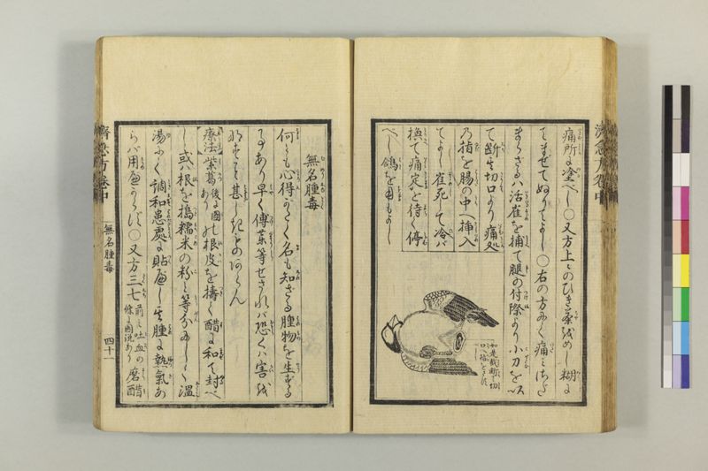 広恵済急方 3巻 - ページ 151