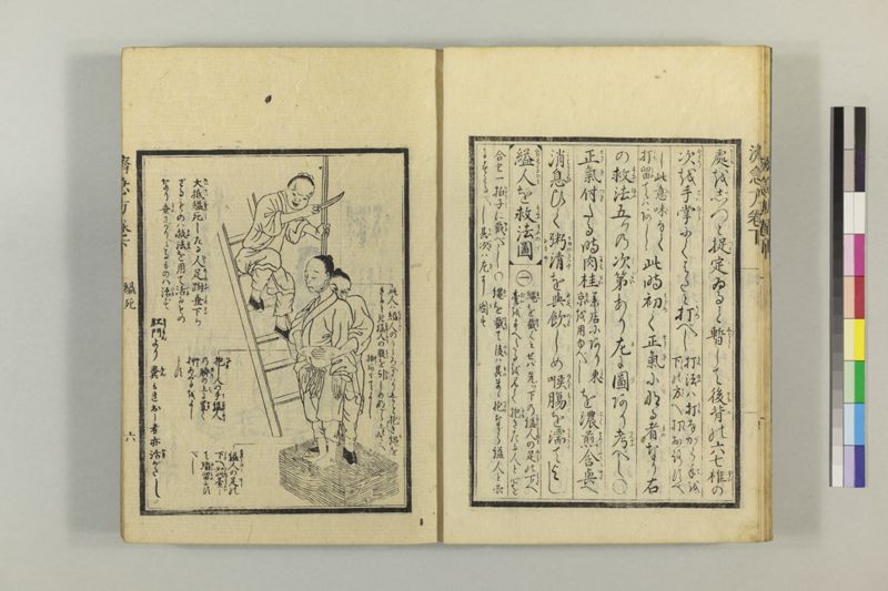 広恵済急方 3巻 - ページ 217