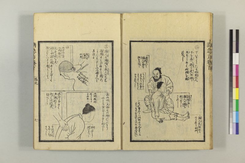 広恵済急方 3巻 - ページ 218